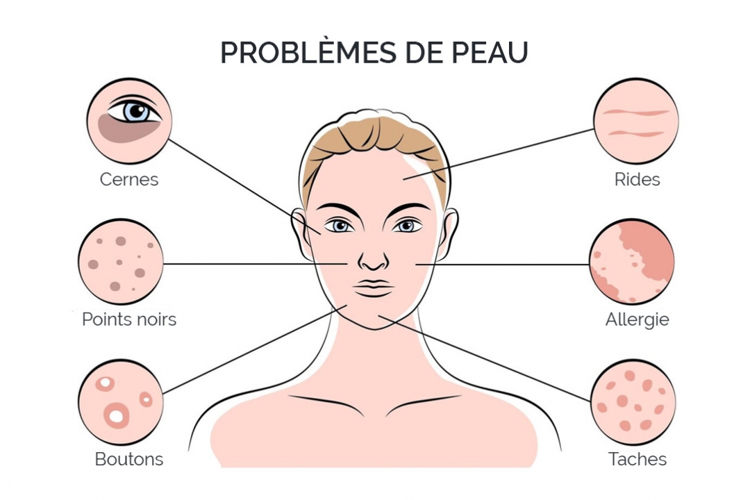 Problèmes de peau